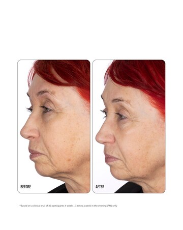 NIP+FAB Retinol Fix Concentrate Extreme 10% - 30ml