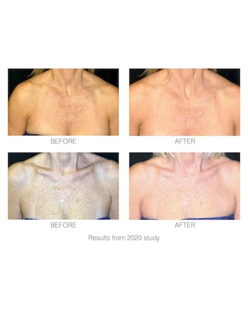Rio DecoLite Neck & Cecolletage Beauty Boosting LED light