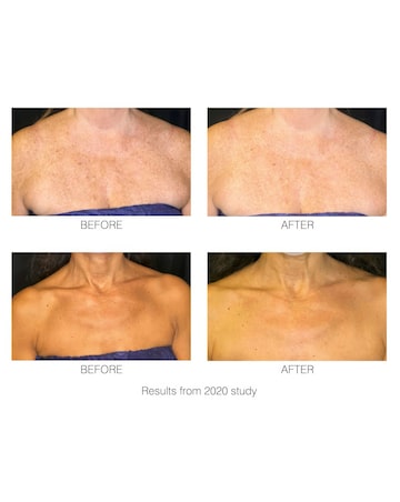Rio DecoLite Neck & Cecolletage Beauty Boosting LED light