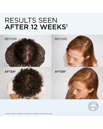 L'Oreal Paris Elvive Growth Booster Shampoo 200ml