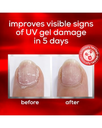 Essie To The Rescue UV gel damage Repair Nail Treatment