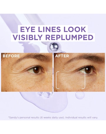 L'Oreal Paris 2.5 Hyaluronic Acid and Caffeine Eye Serum 20ml