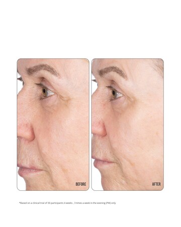 NIP+FAB Retinol Fix Concentrate Extreme 10% - 30ml