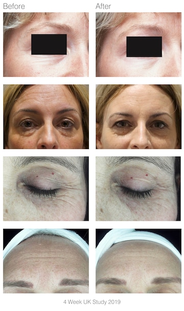 Rio faceLITE Beauty Boosting LED Face Mask