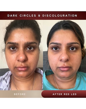 Sensse Elite LED Face Mask - 8 Light