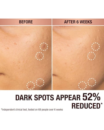 Charlotte Tilbury Dark Spot Serum 30ml