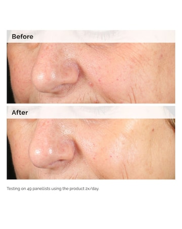 Alpha Arbutin 2% + HA Serum