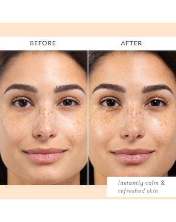 Patchology Skin Remedy Calm & Protect Mist