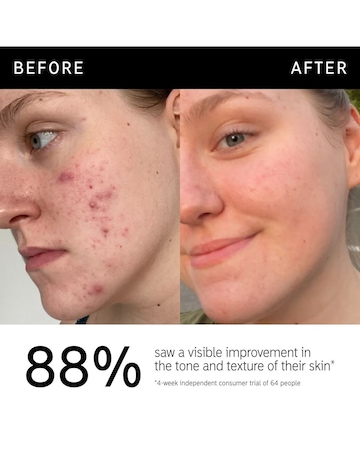 The INKEY 15% Vitamin C And EGF Serum